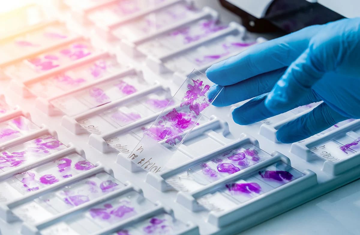 Canceria research approach