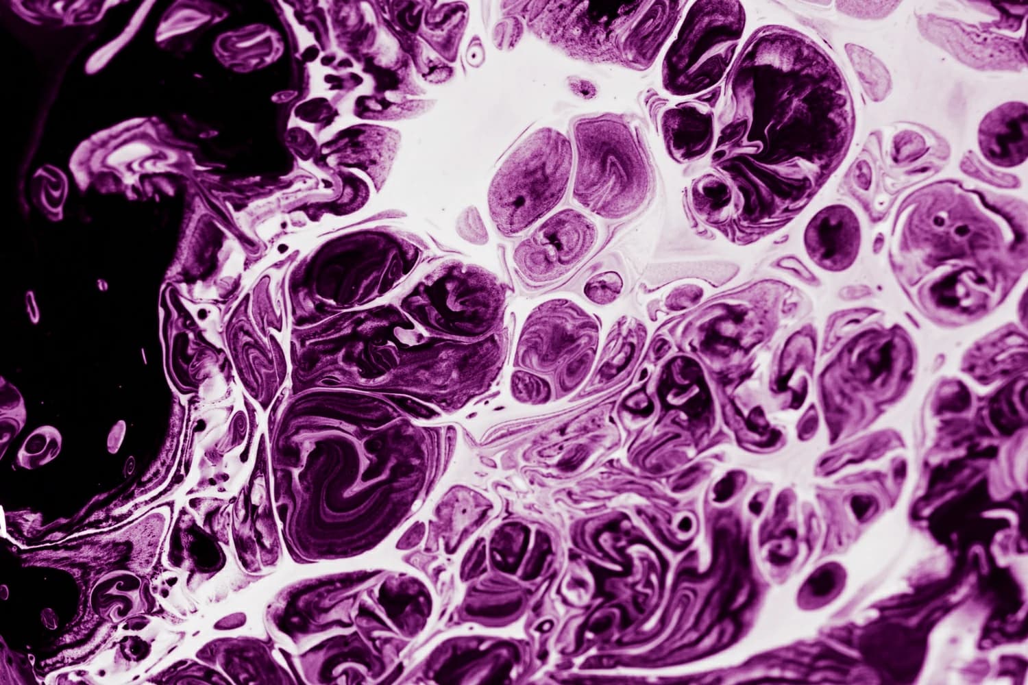 How Cancer Cells Rewire Their Fuel Supply — and Why Diet Can't Simply Outsmart It