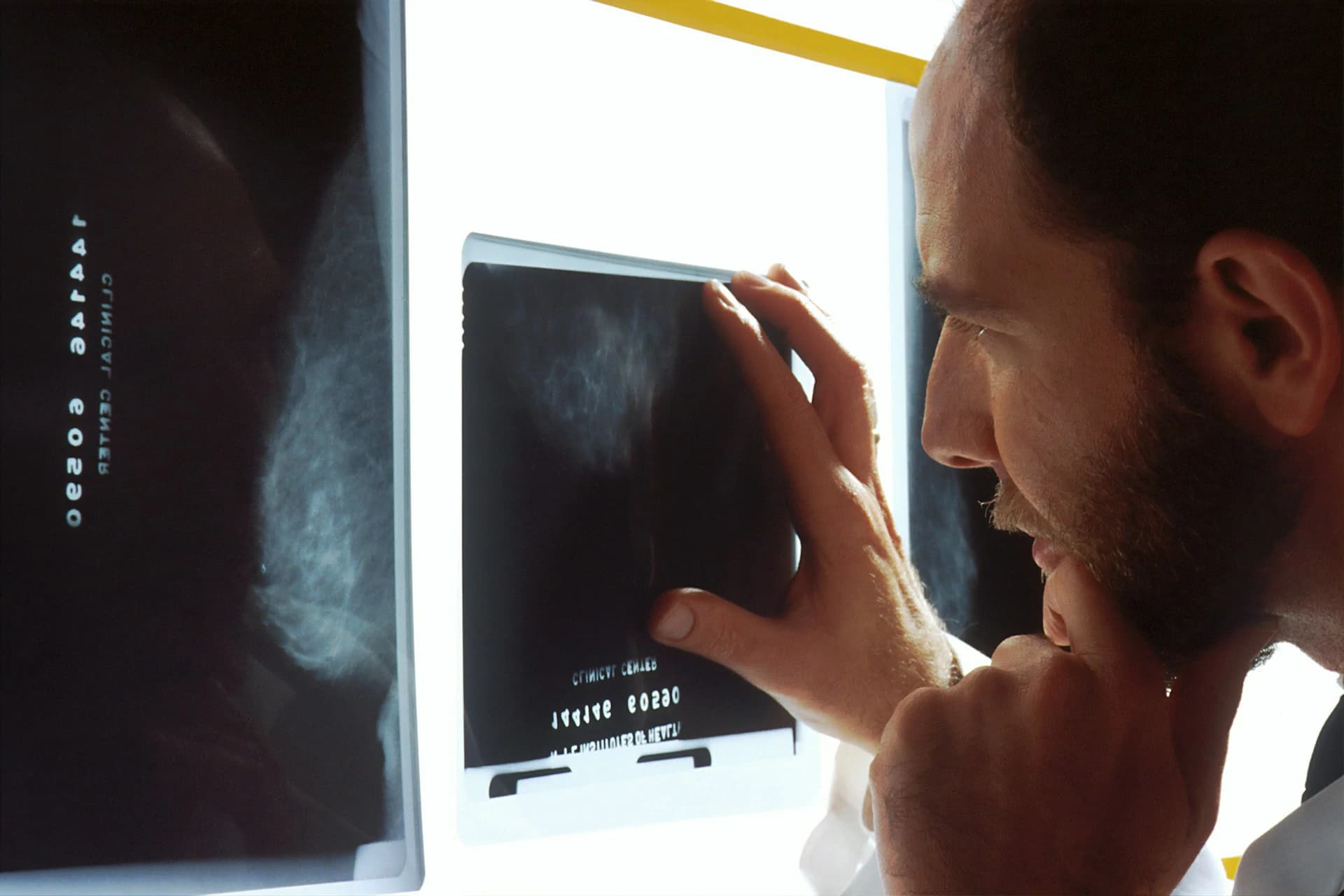 Why Some Cancer Screening Tests Find Cancers That Never Needed to Be Found