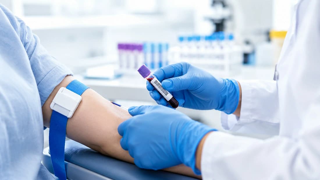 O que os marcadores tumorais em exames de sangue podem — e não podem — dizer
